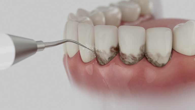 Reliable Tooth Extraction contractor in Emanuel County County, GA by Dentist Open Now
